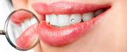 STRASS DENTAIRE ROUGE