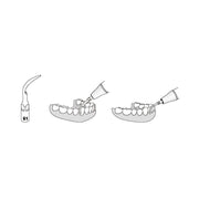 INSERT GD1 POUR PROPHYLAXIE COMPATIBLE SATELEC - REFINE
