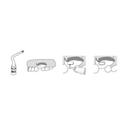 INSERT UL3 POUR CHIRURGIE COMPATIBLE MECTRON - WOODPECKER